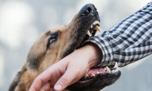 Why Should I Hire Passalacqua & Associates, LLC After a Dog Bite in Utica, NY?